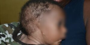 baby-born-without-ears-needs-your-help-1